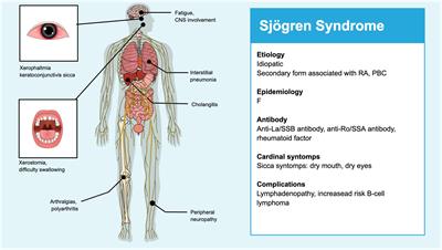 Sjögren syndrome induced by anti PDL-1 treatment for TNBC: case report and review of literature